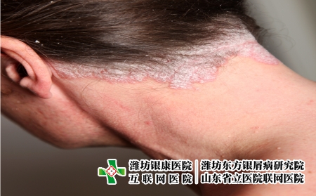 攝圖網(wǎng)_327944171_嚴重皮絲蟲病     頸部（企業(yè)商用）